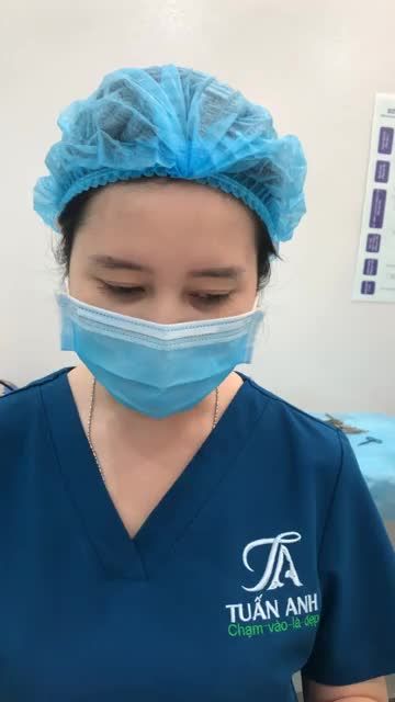 NÂNG MŨI CẤU TRÚC