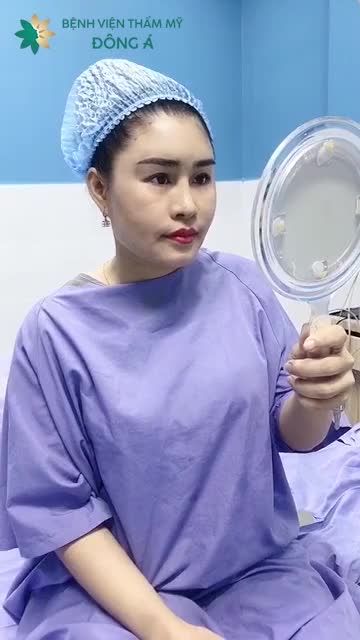 Chỉ CẤY MỠ MẶT 60 phút có ngay mặt tròn đầy, căng mịn
