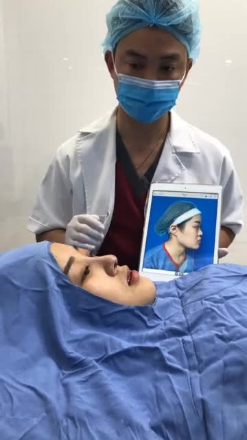Thế nào là nâng mũi trong giới hạn cho phép? Da mũi mỏng nâng cao như thế nào là hợp lý.