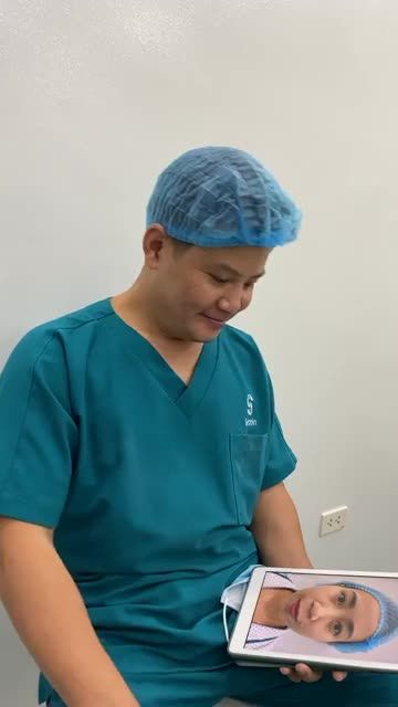 NÂNG MŨI S-Line - THU GỌN CÁNH MŨI - ĐỘN CẰM V-Line