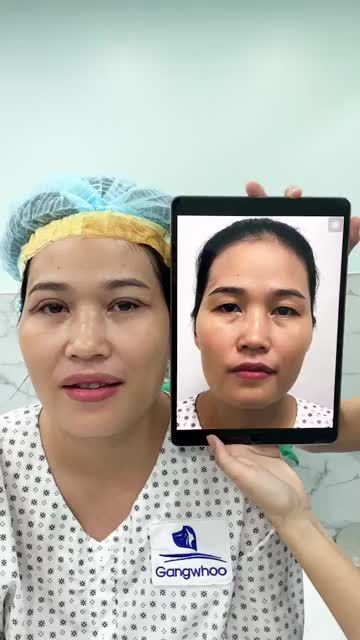 Đôi MẮT 4in1 cực kì có hồn tạo một điểm nhấn trên đôi mắt thôi mà nhìn gương mặt vui tươi lên rất nhiều không còn buồn như đôi mắt cũ