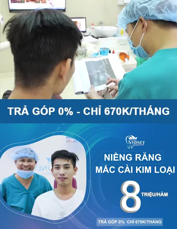 Niềng răng mắc cài kim loại được coi là giải pháp chỉnh nha tối ưu hiện nay