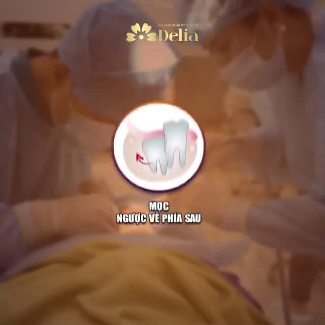 RĂNG "KHÔN" - NIỀM ĐAU KHÔNG CỦA RIÊNG AI