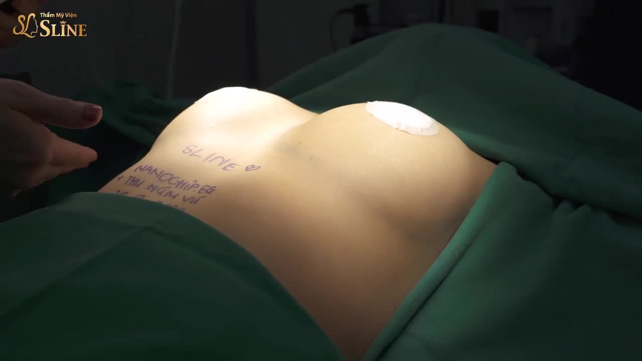SAU NÂNG NGỰC, VÒNG 1 SẼ NHƯ THẾ NÀO?