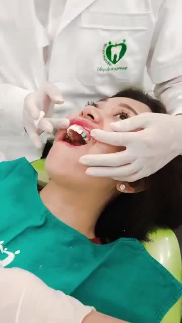MỖI NGÀY 3-4 CASE LÀM ĐẸP NỤ CƯỜI CHO KHÁCH HÀNG