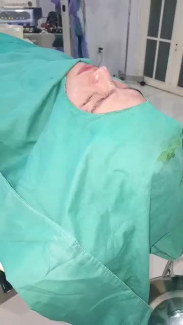 Kết quả sau phẫu thuật tạo hình mũi dáng tự nhiên cho a khách hàng trước phẫu thuật có dáng mũi thấp tẹt
