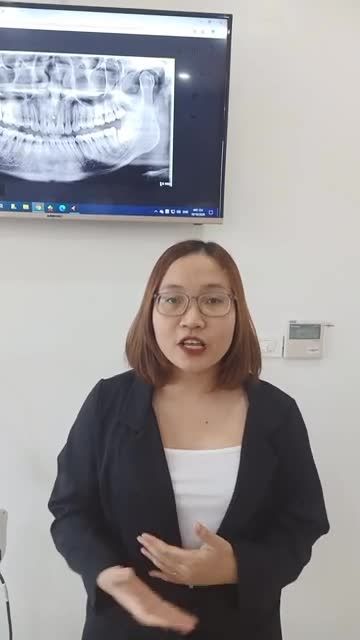 NHỔ RĂNG KHÔN MỌC LỆCH TẠI ATHENA 10/10