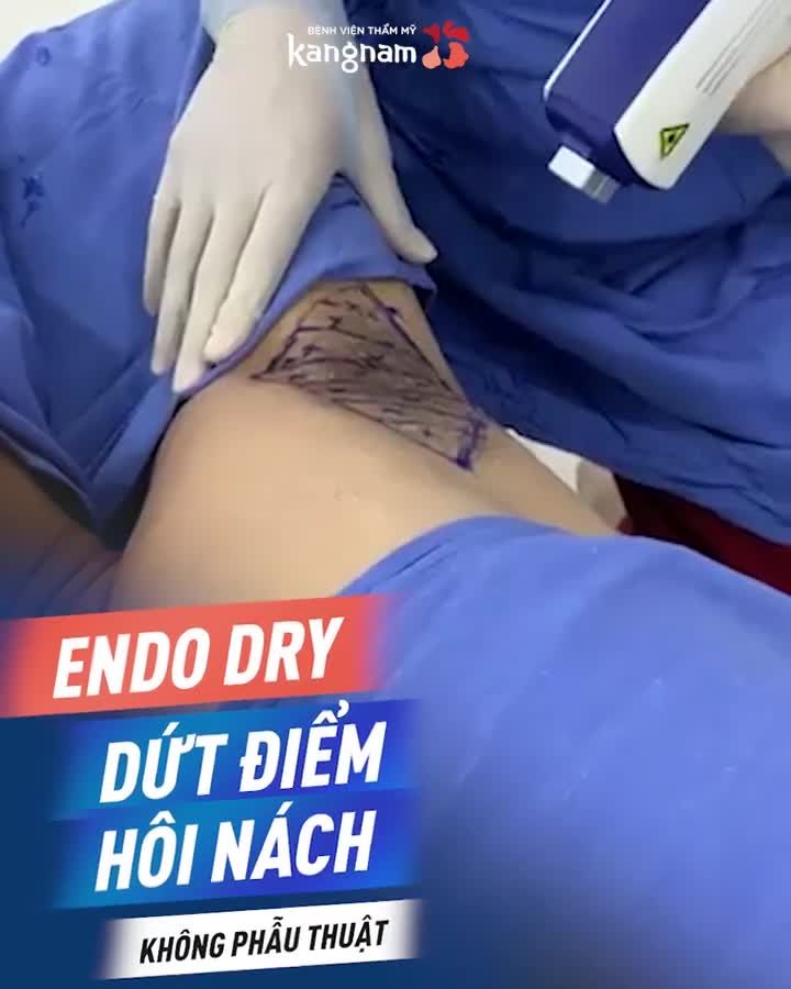 TRỊ HÔI NÁCH thế nào là AN TOÀN - HIỆU QUẢ nhất?