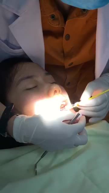 DÁN SỨ VENEER: TRẮNG ĐẸP TỰ NHIÊN – ĂN NHAI THOẢI MÁI