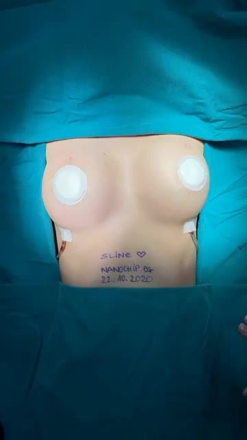 BYE BYE TEO LÉP VỚI SIZE 320cc