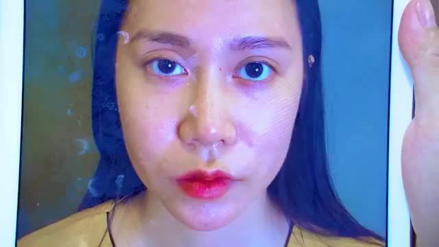 GIẢI CỨU MÍ LỖI HỎNG TẠI DR.HẢI LÊ HỒI SINH ĐÔI MẮT ĐẸP TỰ NHIÊN CHO KHÁCH HÀNG BẰNG KỸ THUẬT SỬA MÍ DEEPTECH20