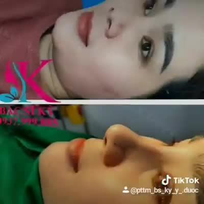NÂNG MŨI BÁC SĨ KỲ Y DƯỢC