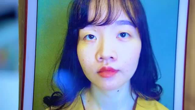 Kết quả cắt mí đẹp xuất sắc cải thiện thần thái tự nhiên rạng rỡ trên khuôn mắt của khách hàng - Mời cả nhà cùng theo dõi
