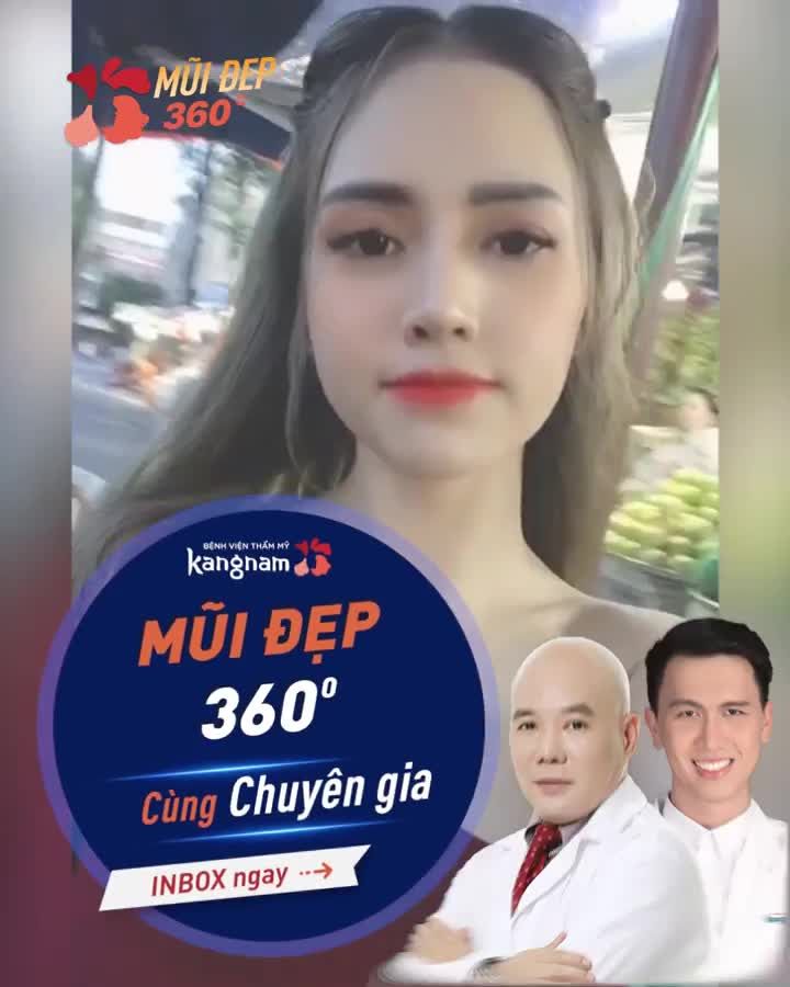 Mũi to - thô và màn biến đổi "xinh như HOT GIRL" sau 2 năm Nâng mũi