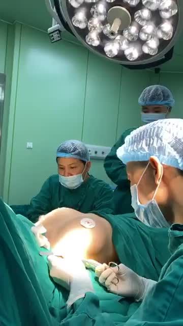 NÂNG NGỰC túi SEBBIN siêu nhám TRỌN GÓI " túi ngực bảo hành trọn đời "
