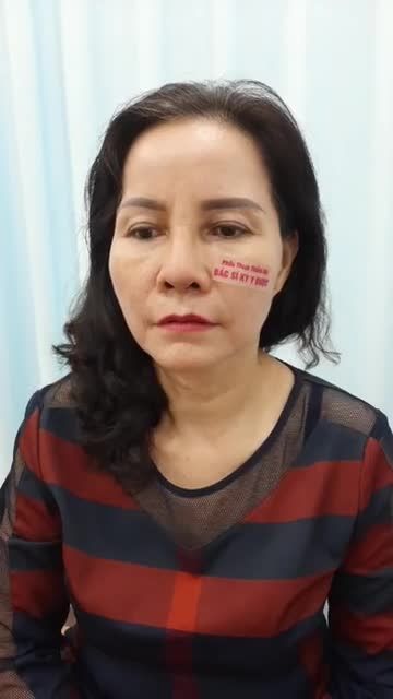 KHÁCH HÀNG TÁI KHÁM SAU 10 NGÀY PHẪU THUẬT