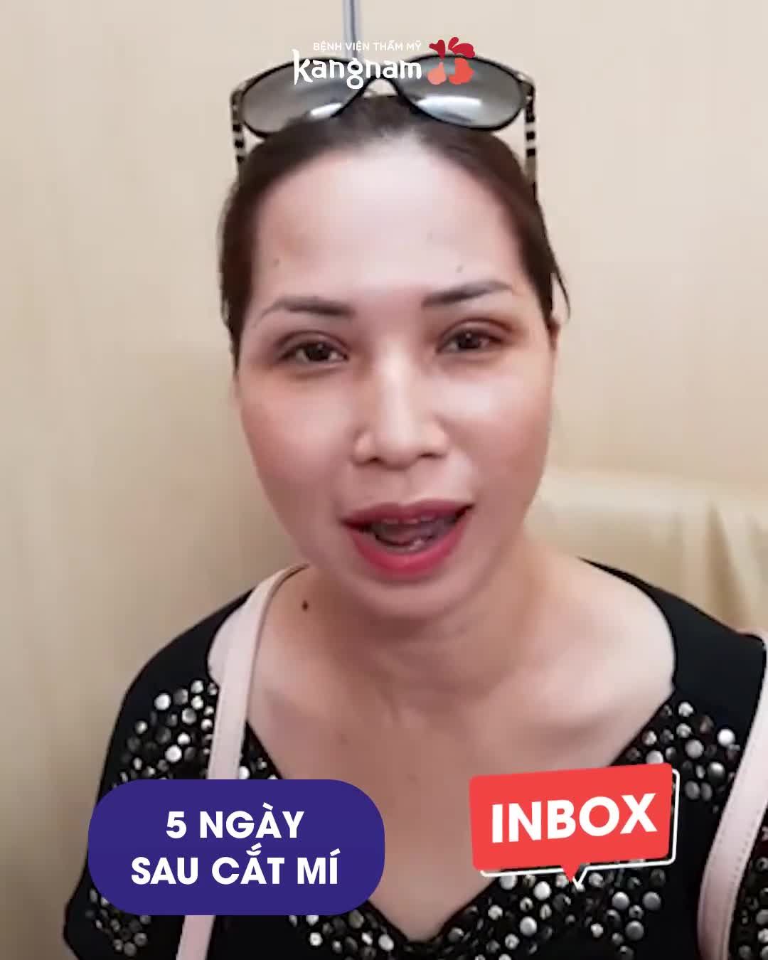 NẾP MÍ KHÔNG ĐỀU, DA CHÙNG