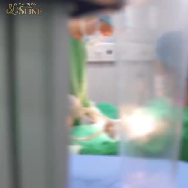 HÚT MỠ BỤNG TẠO HÌNH THÀNH BỤNG MINI