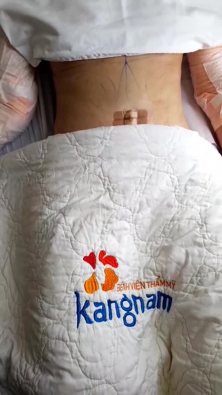 Giảm mỡ ĐI Chờ đợi CHI