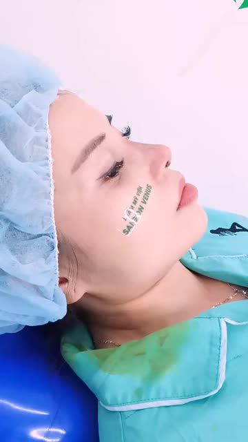 NÂNG MŨI CẤU TRÚC FASCIA Mũi đẹp an toàn - Cam kết thay đổi toàn diện
