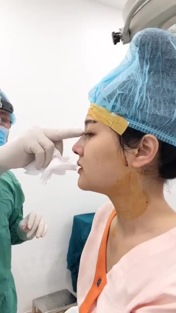 Sang chảnh ngay sau 120 phút nâng mũi
