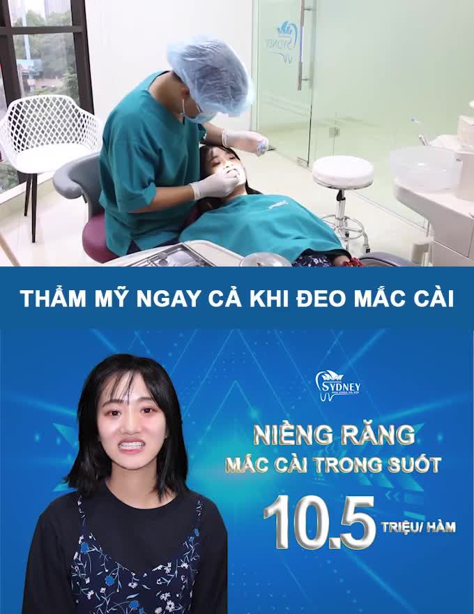THOÁT KHỎI HÀM RĂNG LỆCH LẠC NHỜ NIỀNG RĂNG TRẢ GÓP CHỈ 920K MỖI THÁNG