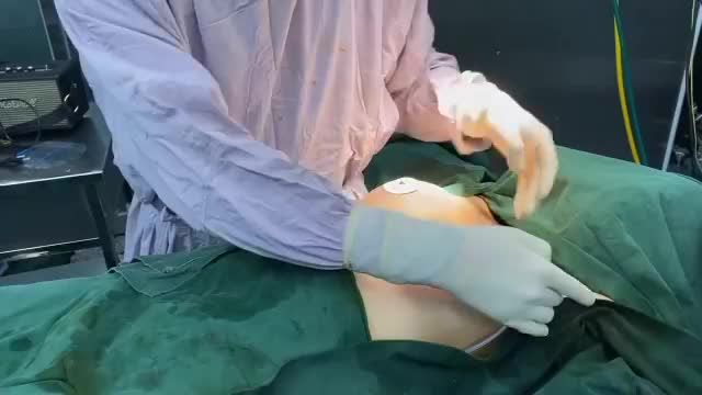 VÌ SAO NÂNG NGỰC DUAL PLANE NỘI SOI ĐANG DẦN “LÊN NGÔI”?