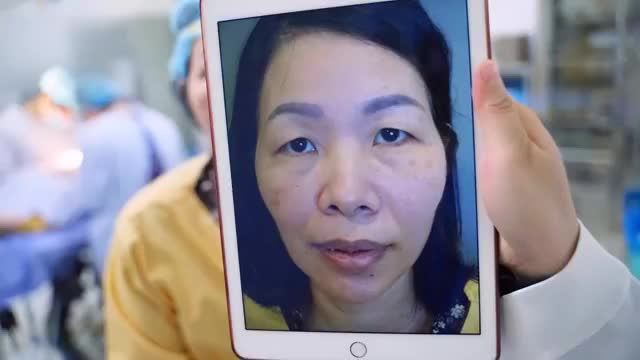 Mời quý khách hàng cùng theo dõi kết quả Cắt Mí đẹp xuất sắc trẻ đến 10 tuổi ngay sau khi thực hiện