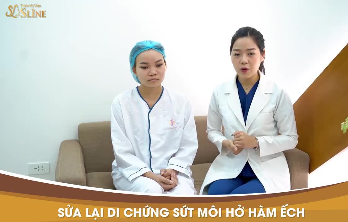 Nâng mũi Cấu Trúc Softxil + Sửa Sẹo Môi.