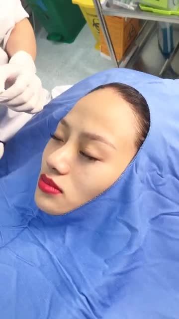 Khoe nhẹ dáng mũi đẹp cao sang ngay sau cắt chỉ