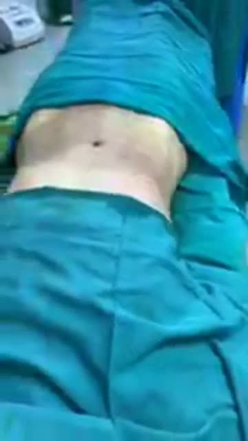 ... hút kiệt mỡ bụng ! …