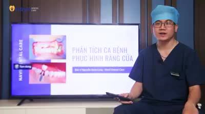Bệnh nhân nam, 20 tuổi đến với chúng tôi trong tình trạng gãy nhiều răng cửa do tai nạn giao thông