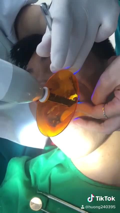 CỨ TƯỞNG NIỀNG RĂNG GIÁ RẺ LÀ RẺ: NHIỀU NGƯỜI "VỠ LẼ" KHI TRAO NHẦM NIỀM TIN