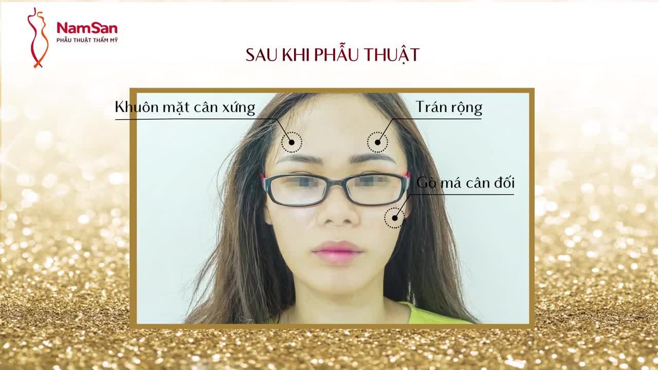 ĐỘN THÁI DƯƠNG- ĐẸP TỰ NHIÊN ĐẦY HOÀN HẢO