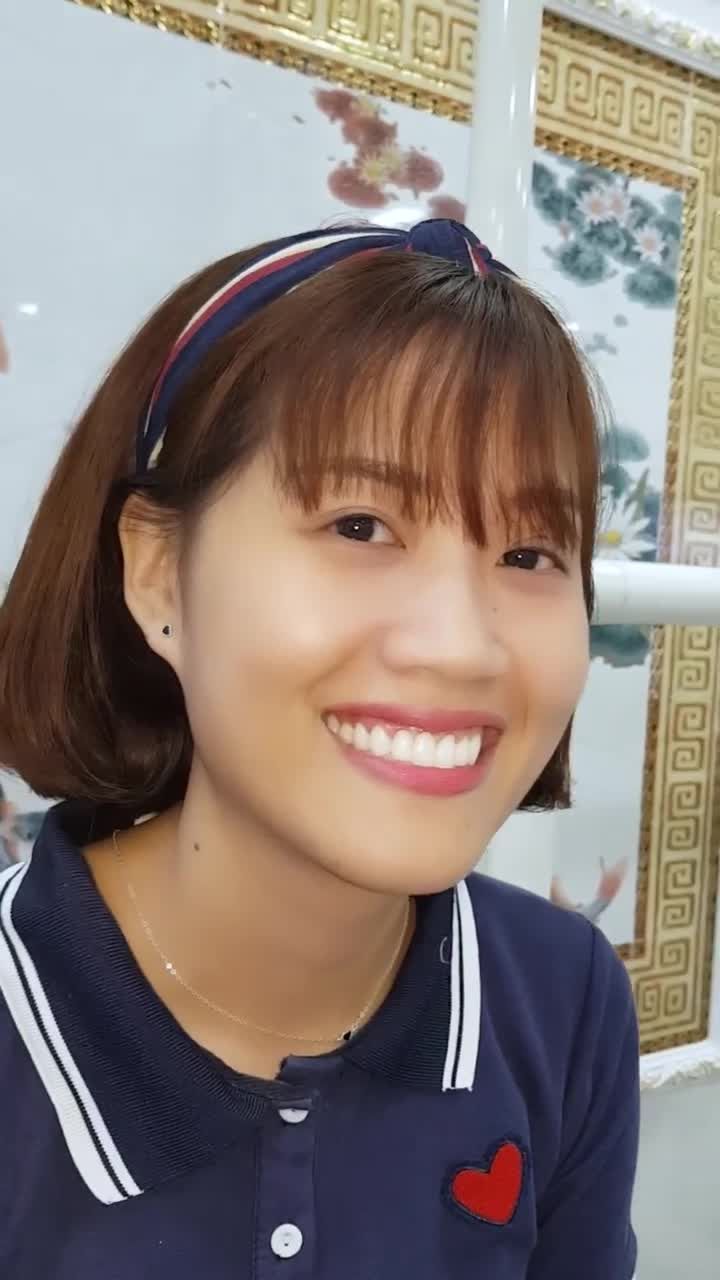 Khách hàng Lưu Thị Thu Hằng tự tin rạng rỡ với nụ cười mới sau phục hình 16 răng sứ Cercon kết hợp cắt lợi và cắt phanh môi tại Nha khoa Quốc tế Việt Đức.