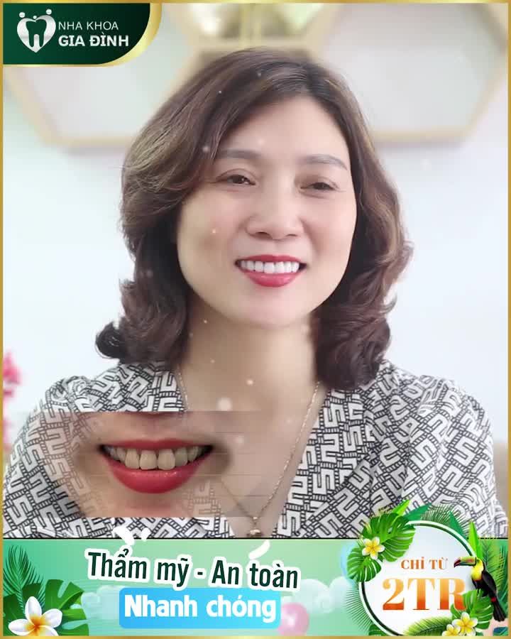 RĂNG TRẮNG MIỆNG DUYÊN – CƯỜI TƯƠI KHÔNG NGẠI