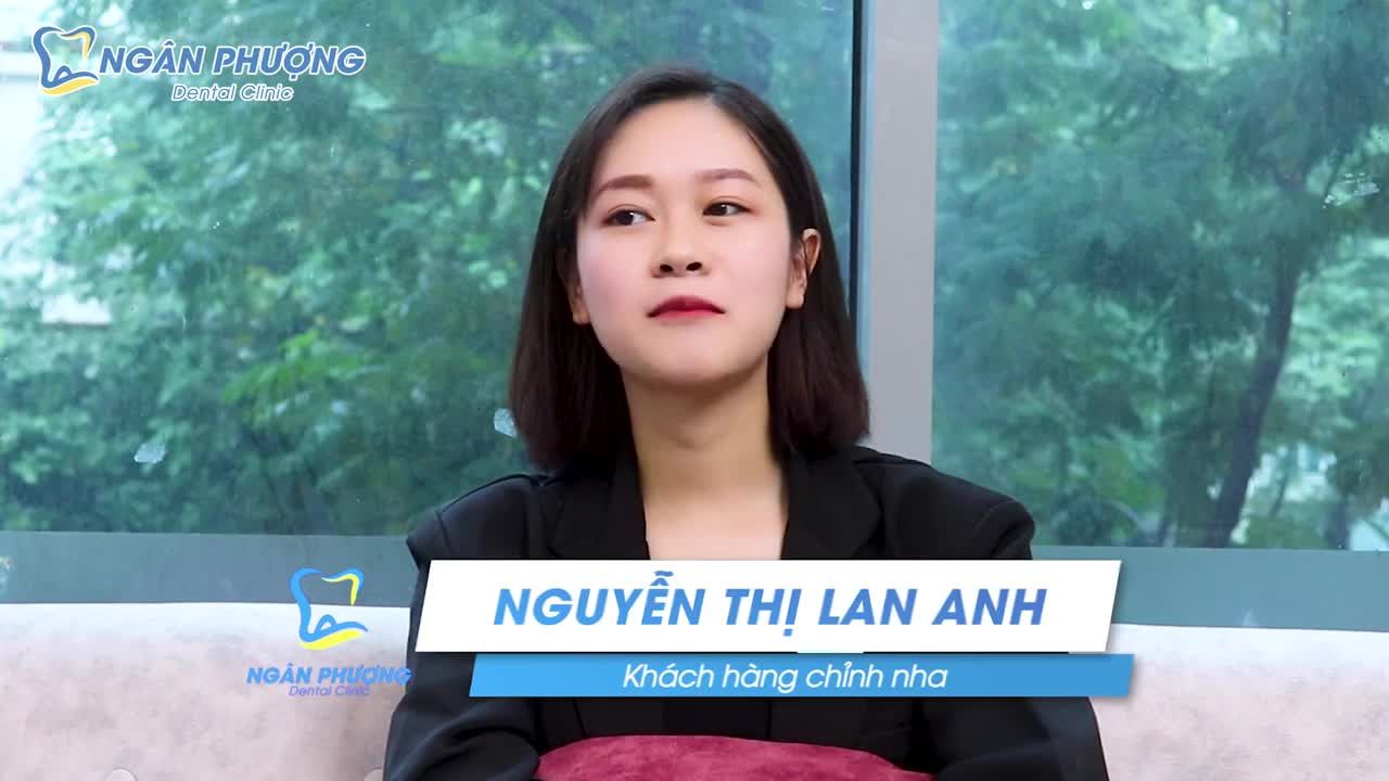 Review sau 18 tháng niềng răng tại Nha Khoa Ngân Phượng
