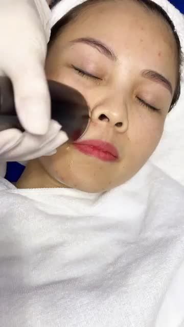 2 buổi điện di tinh chất, sở hữu ngay làn da căng bóng, mịn màng
