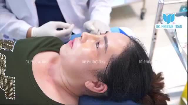 NÂNG MŨI KHÔNG ĐAU NHƯ BẠN NGHĨ