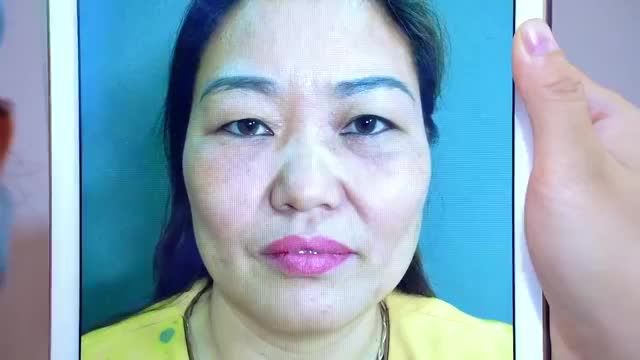 Mắt sụp mí già nua u buồn khắc phục như thế nào?