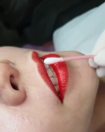 Phun môi BabyLips vừa thực hiện xong, không sưng, không đau, màu đẹp tự nhiên rạng rỡ
