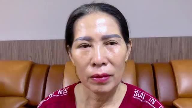 Combo trẻ hóa đôi mắt Nâng cung mày + Cắt mí dưới giúp khách hàng U40+ trở nên rạng rỡ như thế nào?