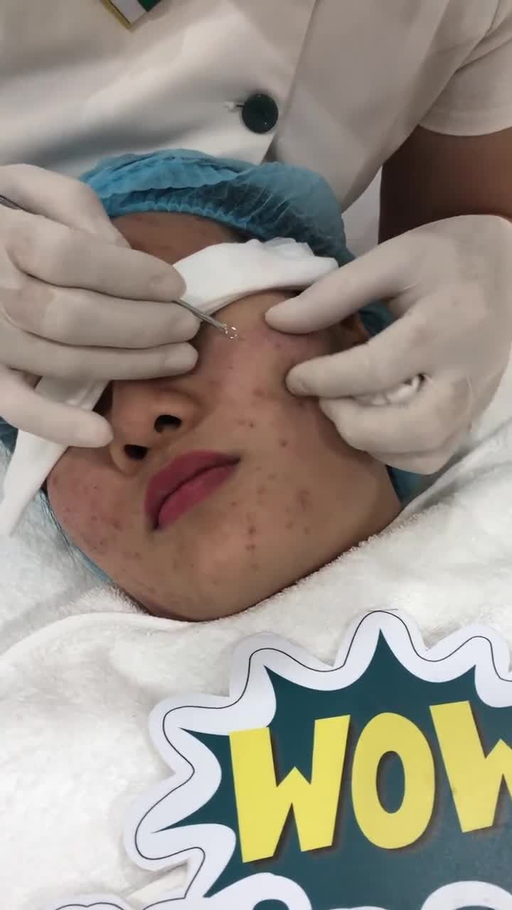Mụn ẩn, mụn viêm, mụn thâm... Loại mụn nào Đông Á Sài Gòn cũng chấp hết!
