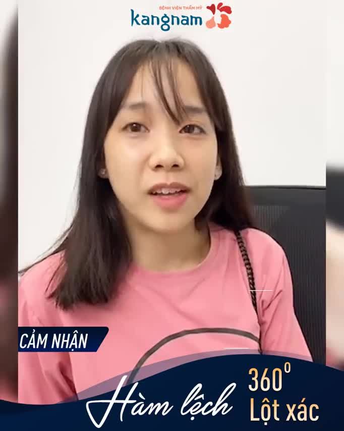 Màn lột xác thành "thiên nga" của cô gái MẶT LỆCH
