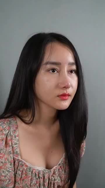 KHÁCH HÀNG HẠNH NGUYÊN TÁI KHÁM SAU 10 NGÀY NÂNG MŨI CẤU TRÚC TẠI SAIGON STAR - DR. HOẠT