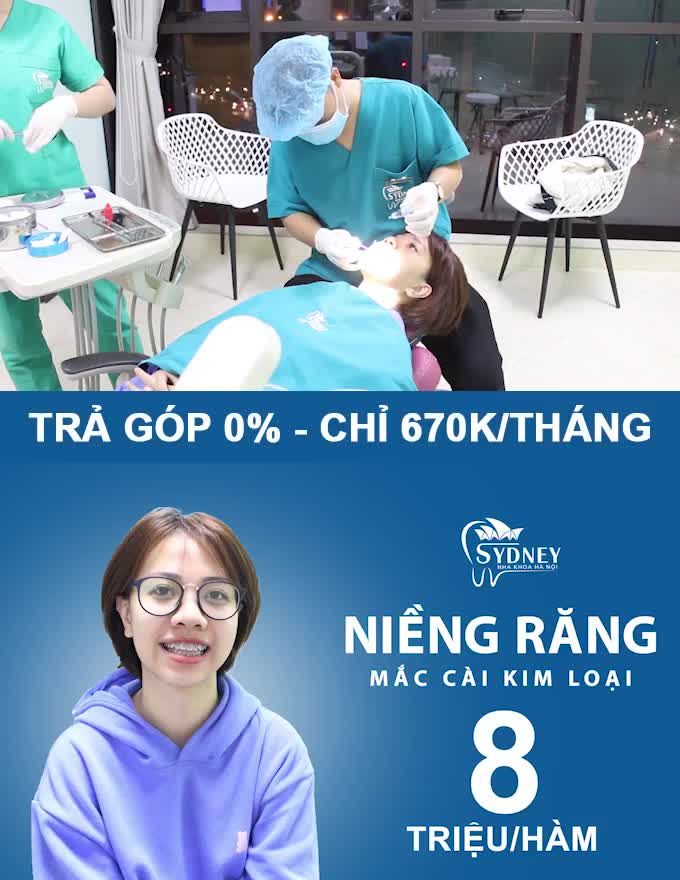 NIỀNG RĂNG MẮC CÀI KIM LOẠI CHỈ 670K/ THÁNG