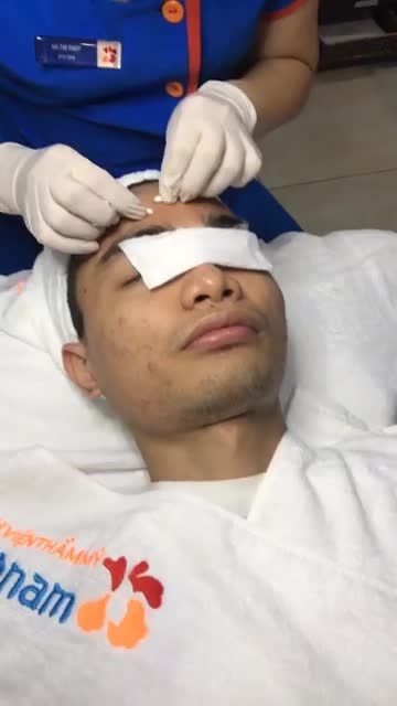 MỤN CÓ ĐÁNG ĐỂ LO? - KHÔNG LO KHI TỚI KANGNAM ĐIỀU TRỊ NHÉ  Trực tiếp quy trình điều trị mụn tại kangnam