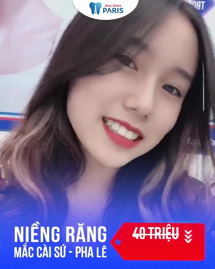 Niềng răng giá tốt nhất năm OFF tới 25%