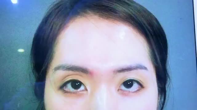 MẮT KHÓ ĐẾN MỨC NÀO DR.HẢI LÊ KHẲNG ĐỊNH ĐỀU CÓ THỂ KHẮC PHỤC CHO BẠN