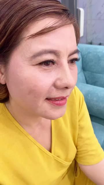 Dáng mũi của khách hàng U40 lên dáng mũi trẻ hoá gương mặt lên đến chục tuổi.